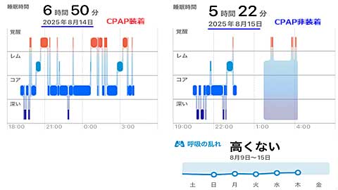 睡眠へのCPAPの影響